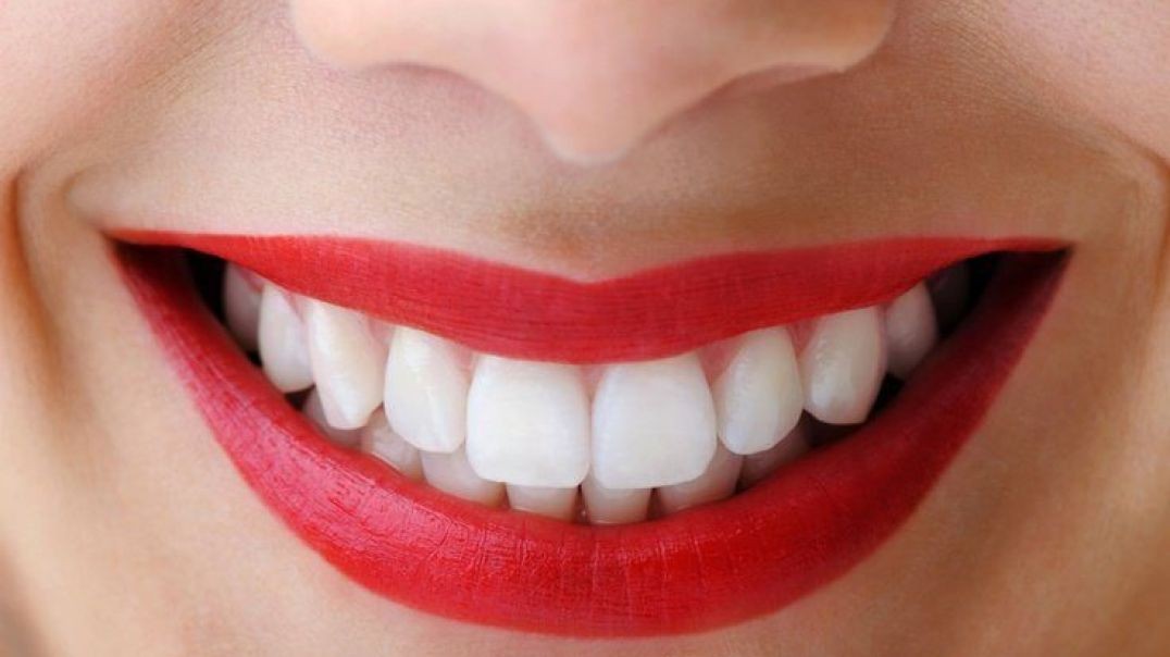 ⁣Miami Dental Group - Teeth Whitening in West Kendall, FL