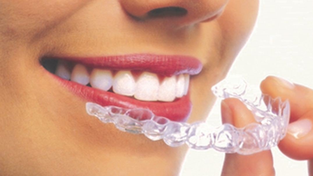 ⁣Mancia Orthodontics : Invisalign in Miami, FL | 33144