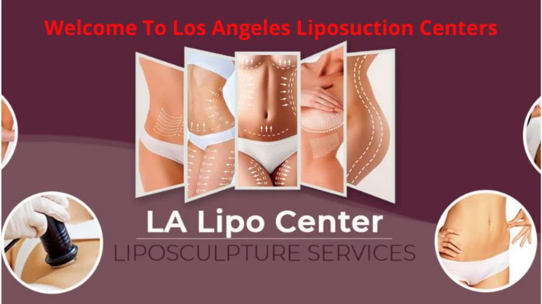 Los Angeles Liposuction Centers : Liposuction in Beverly Hills, CA | 90211