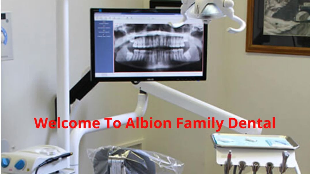 Albion Family Dental : Crown Implants in Albion | (585) 589-9044